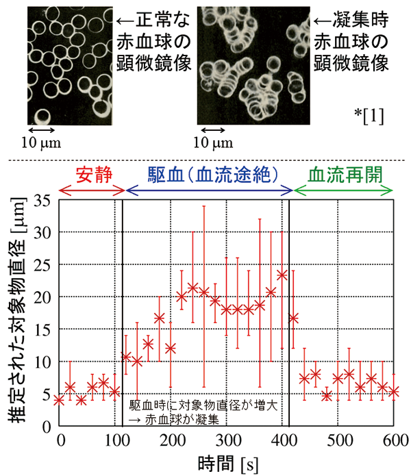 Top: Microscopic image of normal (left) and aggregated (right) red blood cells (RBCs) ([1] J. R. Privitera et al., Silent clots: Life's biggest killers, Translated by K. Ujiie. Chuo Art, Tokyo.)
Bottom: Change in the sizes of ultrasonic scatterers (RBCs) due to aggregation during avascularization