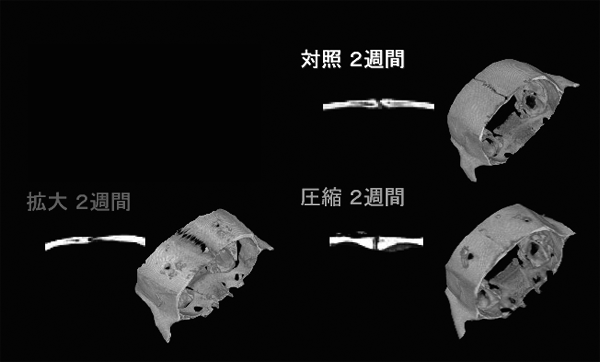 New internalized orthopedic device for craniofacial plastic surgery using Ni-free Ti-based shape memory alloy.