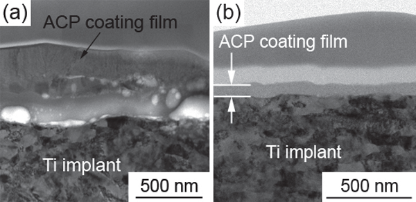 Cross section of amorphous calcium phosphate (ACP) coating film fabricated by RF magnetron sputtering (a) before and (b) after 1 week implantation.