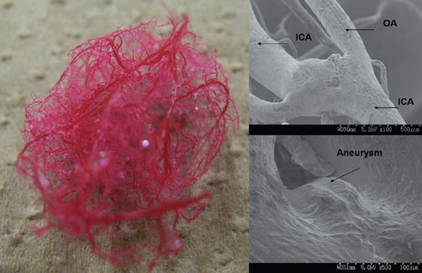 Experimentally induced aneurysm in rat. The process related to the initiation, growth, rupture and cure is analyzed. This model is useful to study new development of endovascular devices and and pharmacological therapy.