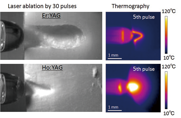 Thermal imaging during laser ablation
