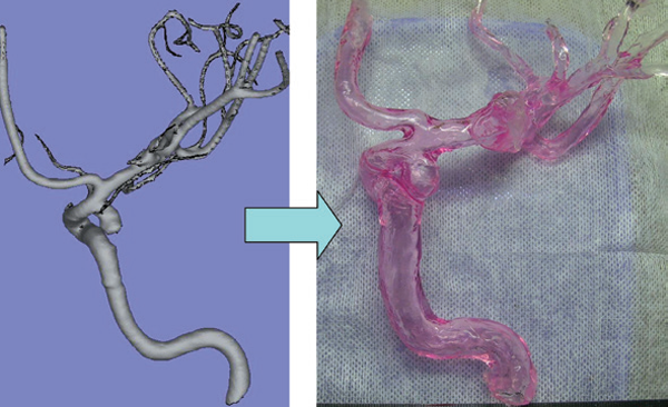 Development of cerebral aneurysm model with realistic physical material properties.