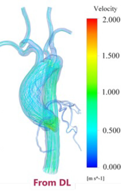 AI-based prediction of blood flow