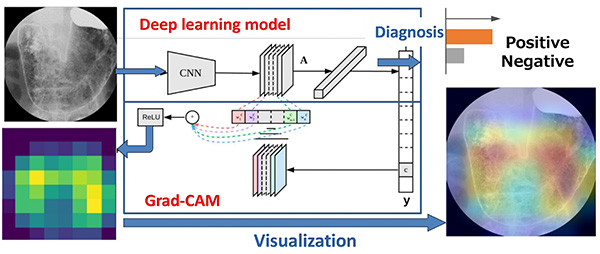 Explainable deep learning-based computer-aided system for H. Pylori infection diagnosis using gastric X-ray images.