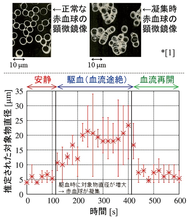 上段： 正常（左）および凝集（右）した赤血球の顕微鏡像（［1］ 氏家京子訳： 沈黙の血栓、中央アート出版社、2000）下段： 駆血（腕をカフで締めて人工的に血流を止める）した際に赤血球が凝集する様子を超音波計測した結果