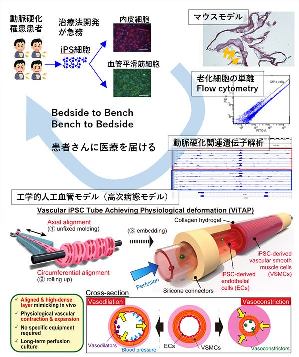 臨床的な課題やニーズに対して生物学、工学的アプローチで取り組み新たな治療を患者さんに届ける（動脈硬化治療開発の一例）