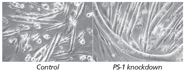 筋芽細胞の未分化維持因子PS-1の抑制による筋分化促進