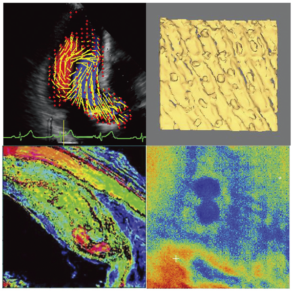 左上：左心室内の血流ベクトル,右上：指紋の三次元超音波像,左下：冠動脈の超音波顕微鏡像,右下：生きた細胞の超音波顕微鏡像