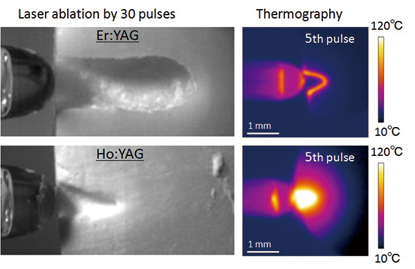 レーザアブレーション中の熱画像