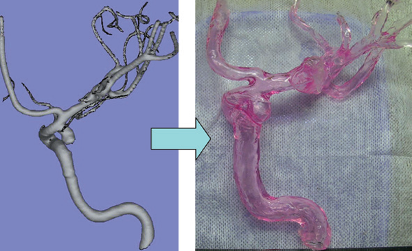 脳動脈瘤および脳動脈の形状と力学的機能を再現した血管モデル