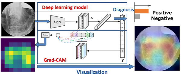 深層学習を用いた胃がん検診画像診断支援システムとその根拠解析