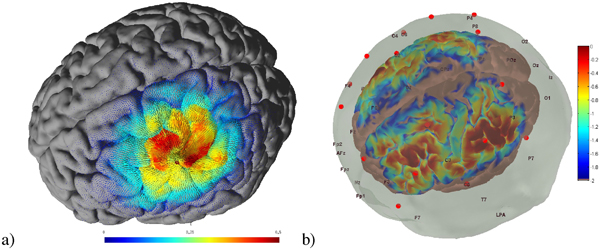 図1 経頭蓋直流電気刺激中のNIRS-EEG同期モデリング